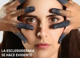 esclerodermia #Yotambien